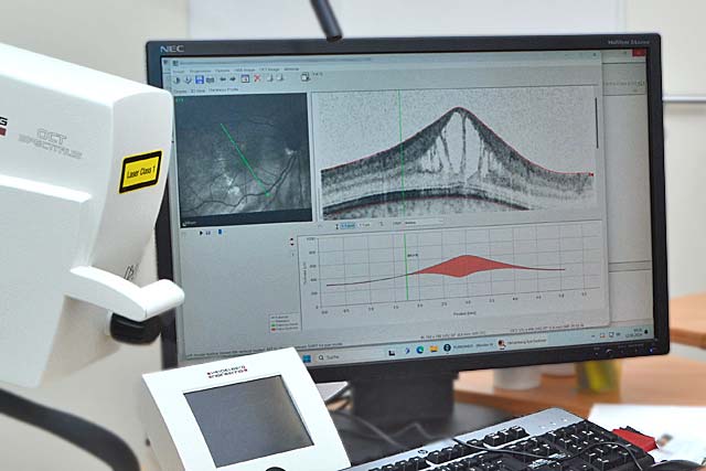 Darstellung des OCT-Befundes im Detail auf dem Monitor